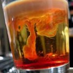 Brain Hemorrhage